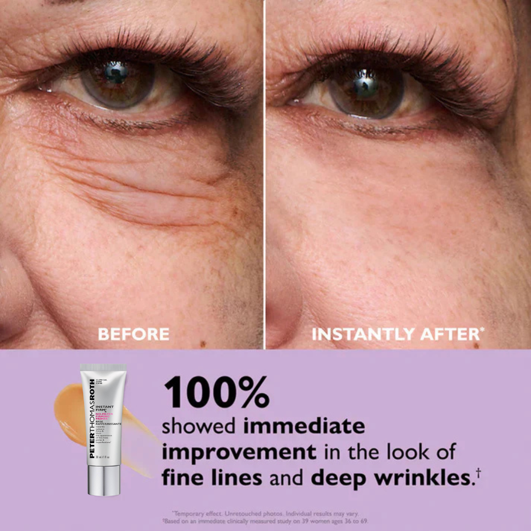 Peter Thomas Roth Instant Eye Tightener + Free Brush
