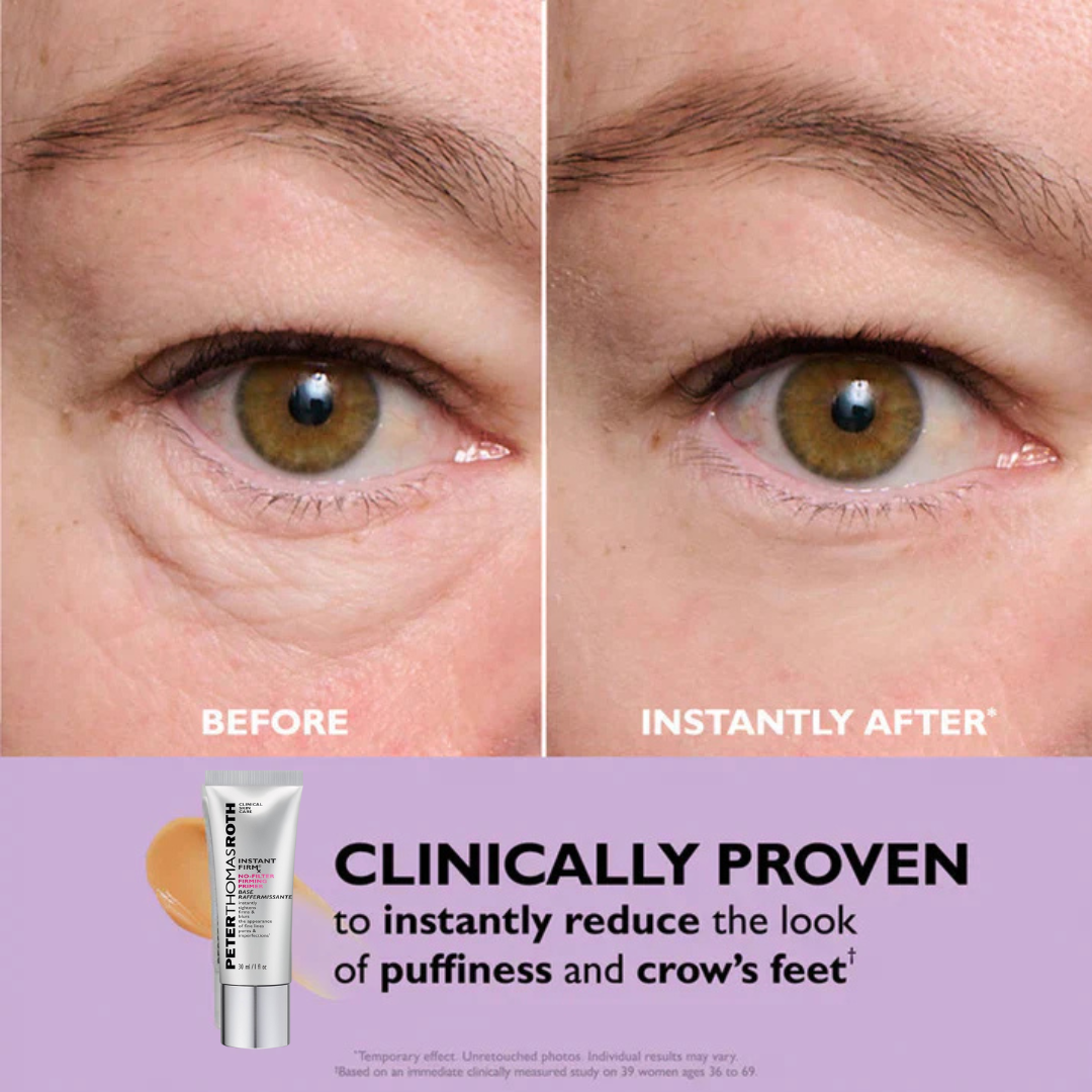 Peter Thomas Roth Instant Eye Tightener + Free Brush