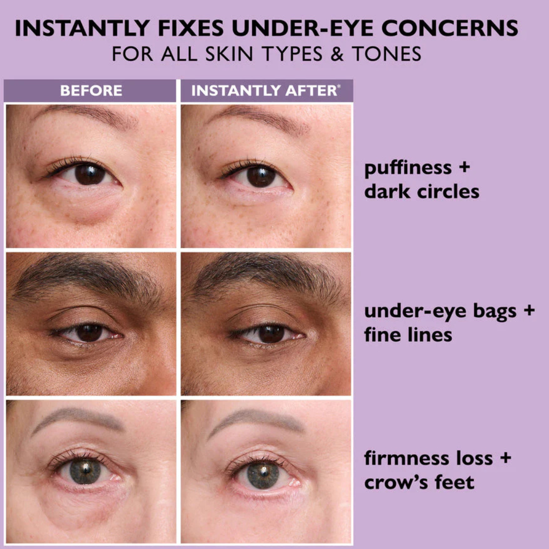 Peter Thomas Roth Instant Eye Tightener + Free Brush